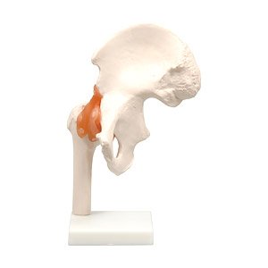 Hip Joint Model (Educational)